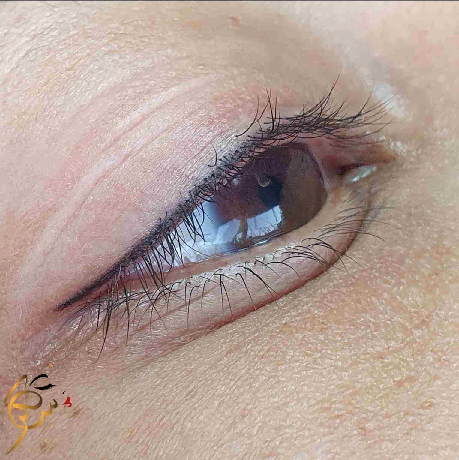 Sugar Beauty Lounge treatment result