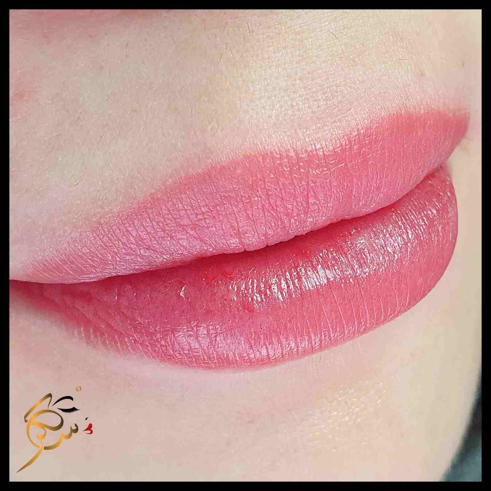 Sugar Beauty Lounge treatment result