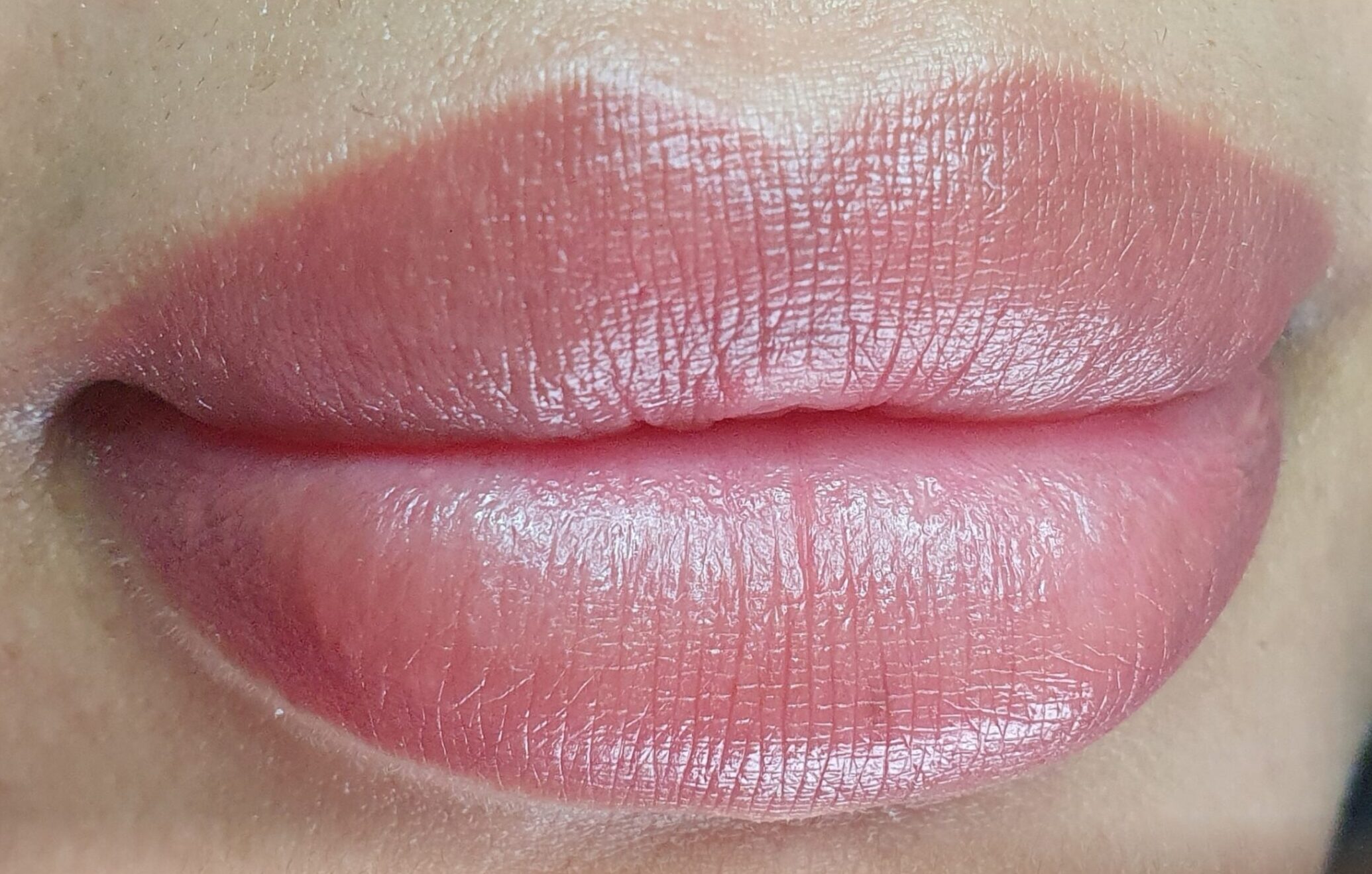 Dark Lip Neutralization